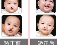 吃兔肉真的會長兔唇？為什么會長兔唇？